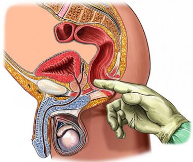Examen de la prostate au doigt