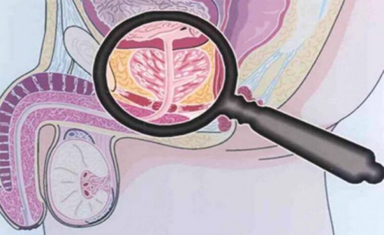 La prostate et sa localisation